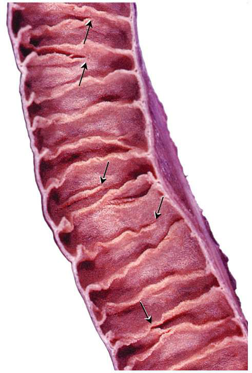 Image of circular folds (plicae circulares) in the small intestine.