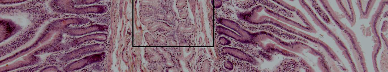 Histology of the duodenum showing Brunner's glands in the submucosa