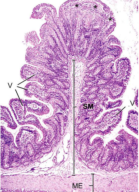 Histologisk snitt av ileum med villi och plica circulares