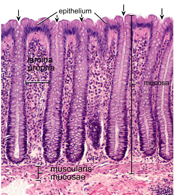 histologisk bild av colon