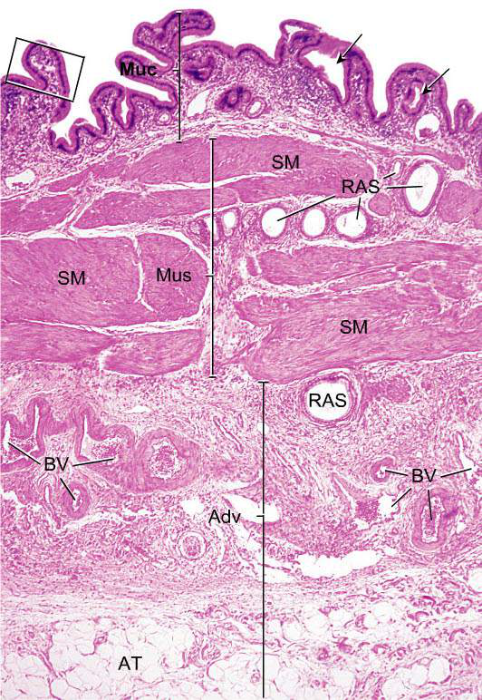 Histologisk bild gallblåsa