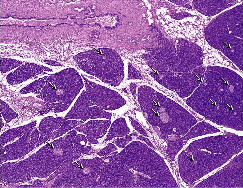 Histologisk bild av pankreas