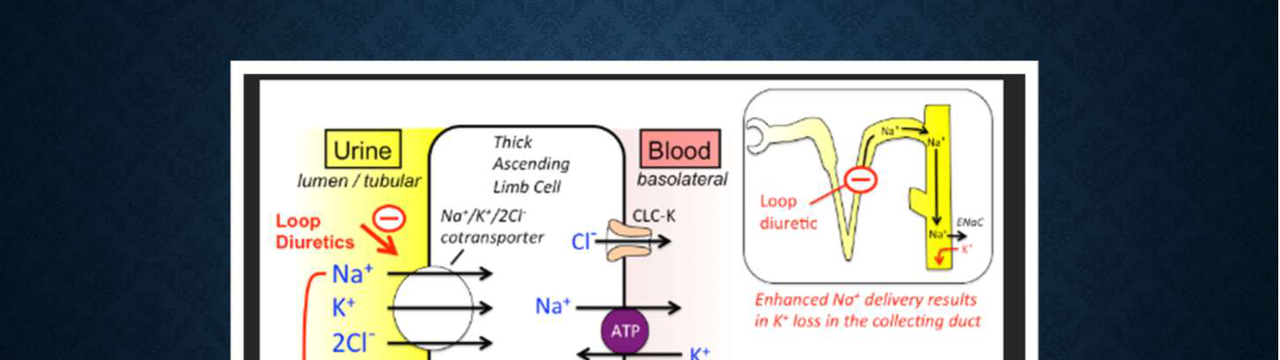 Diagram showing the mechanism of loop diuretics in the nephron