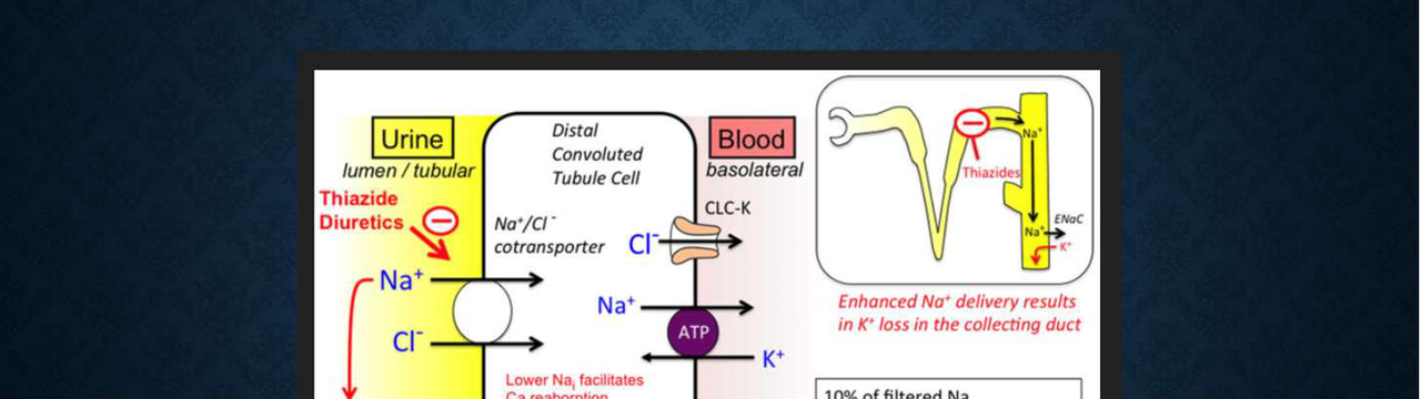 Diagram illustrating the mechanism of thiazide diuretics in the distal convoluted tubule