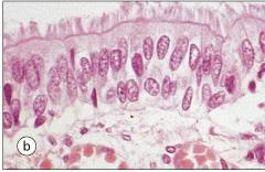 A micrograph showing pseudostratified columnar epithelium. The nuclei are at different levels, giving a stratified appearance, but all cells rest on the basement membrane. The apical surface appears ciliated.