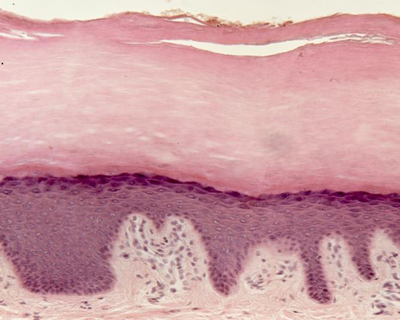 Histological image of keratinized stratified squamous epithelium