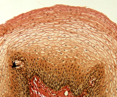 Histological image of non-keratinized stratified squamous epithelium