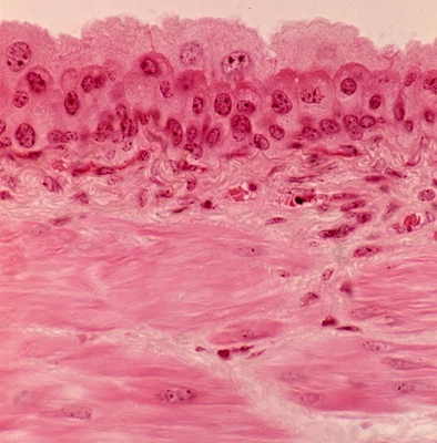 Histologisk billede af overgangsepithel i kontraheret og udstrakt tilstand