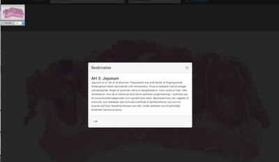 Histologisk snit af jejunum