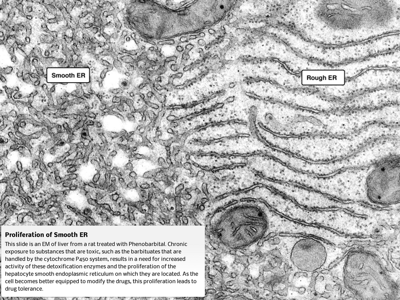Electron micrograph showing the extensive network of smooth endoplasmic reticulum (Smooth ER) and rough endoplasmic reticulum (Rough ER) within a hepatocyte.
