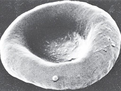 Erythrocyte Electron Micrograph
