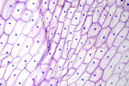 Micrograph of purple onion epidermal cells showing distinct cell walls and visible nuclei.
