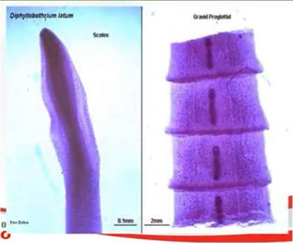 Scolex and gravid proglottid of Diphyllobothrium latum