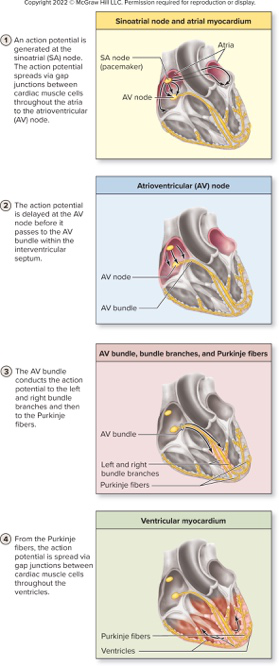 conduction diagram