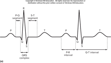 Electrocardiogram (ECG) labeled