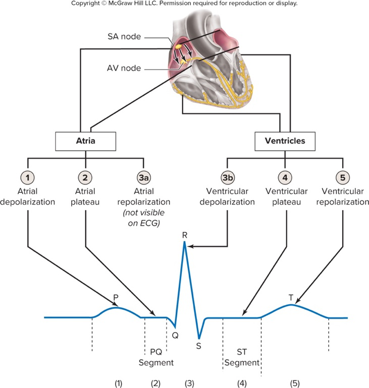 ECG diagram