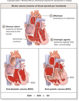 Afterload, Venous Return, Inotropic Agents diagram