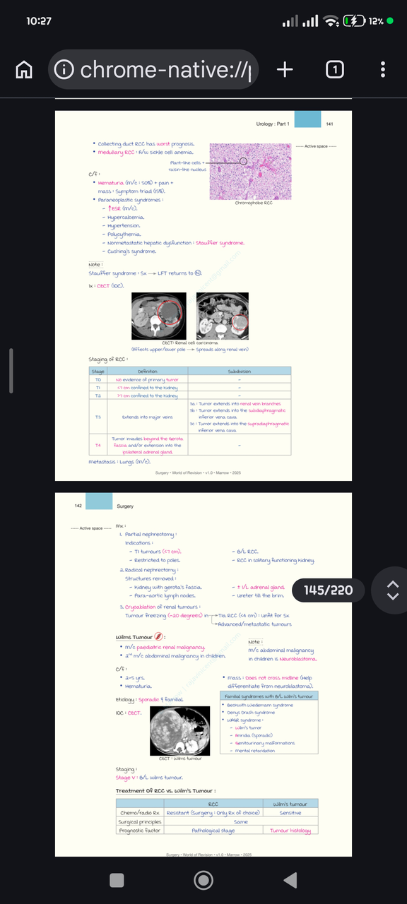 CECT of renal cell carcinoma