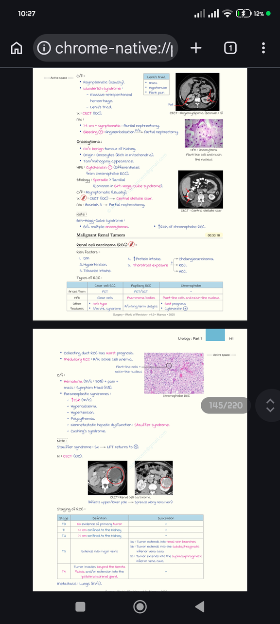 CT scan of oncocytoma showing central stellate scar