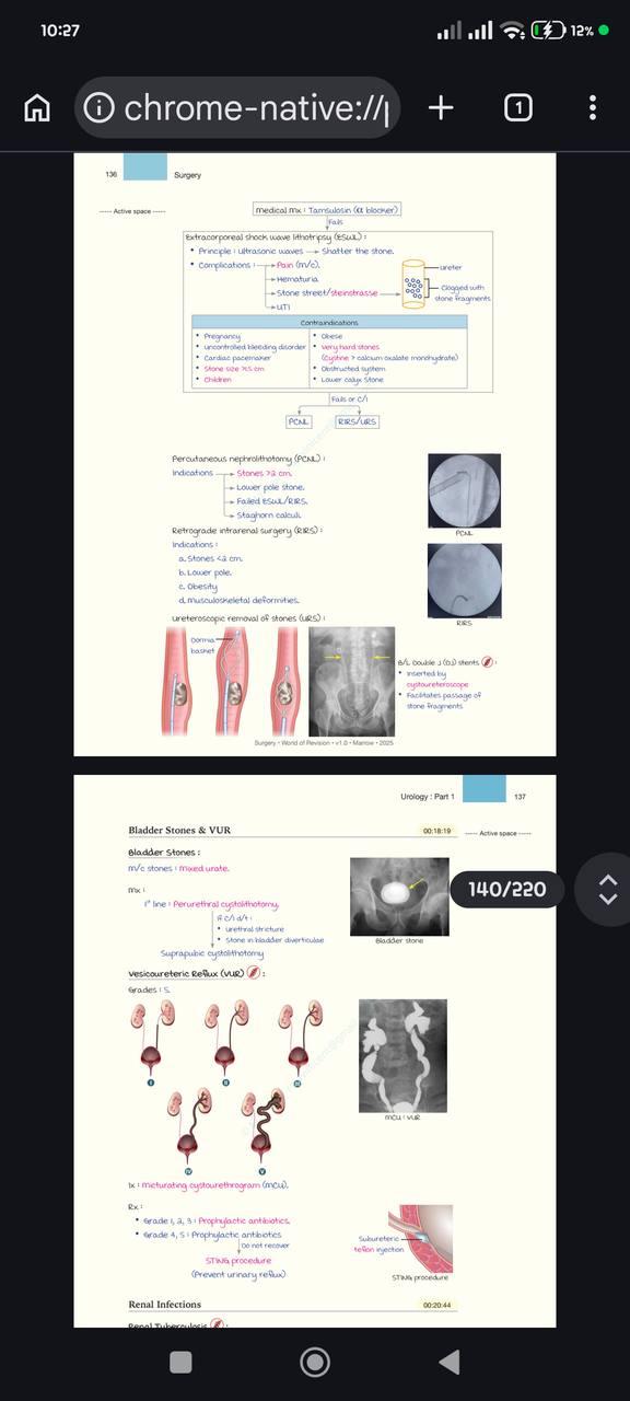 ESWL and related procedures
