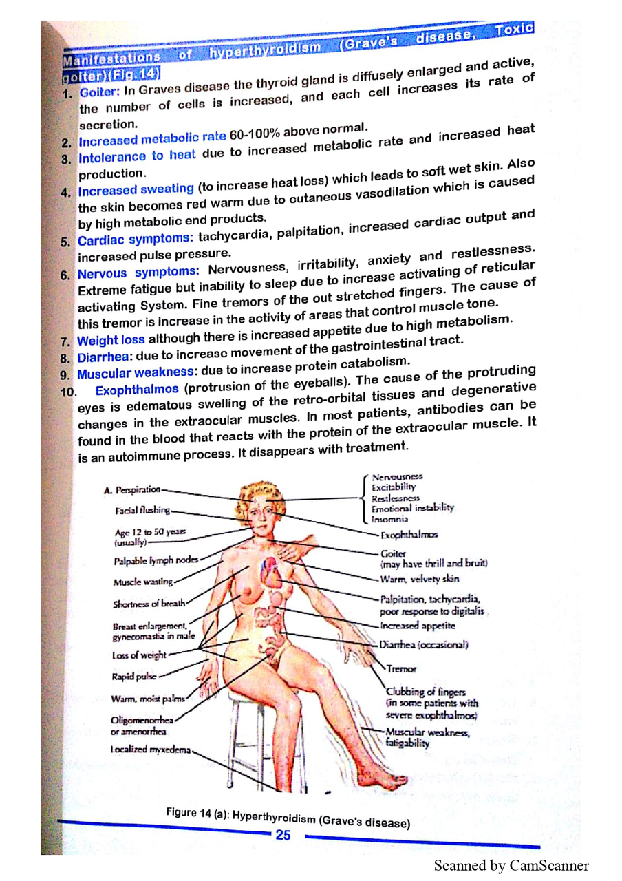 Hyperthyroidism: Graves disease clinical features