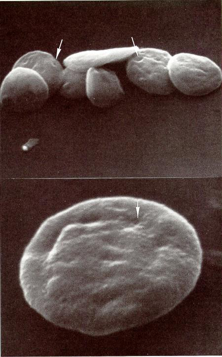 SEM images of platelet surface showing invaginations leading to the OCS