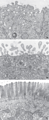 Micrographs showing the apical surfaces of epithelial cells.