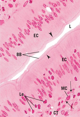 Micrograph of intestinal villi lined by absorptive epithelial cells.