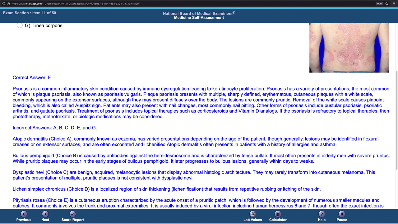 Image of psoriasis on the back