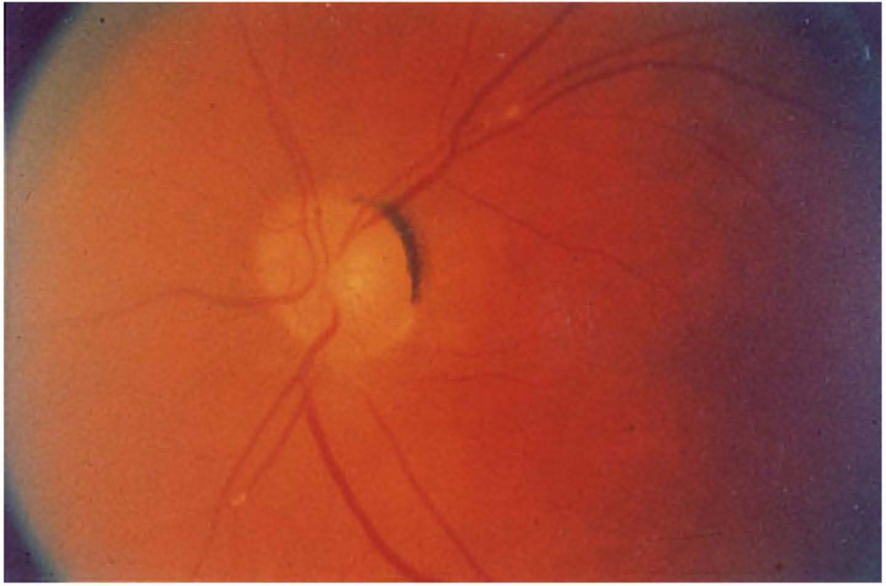 fundus image