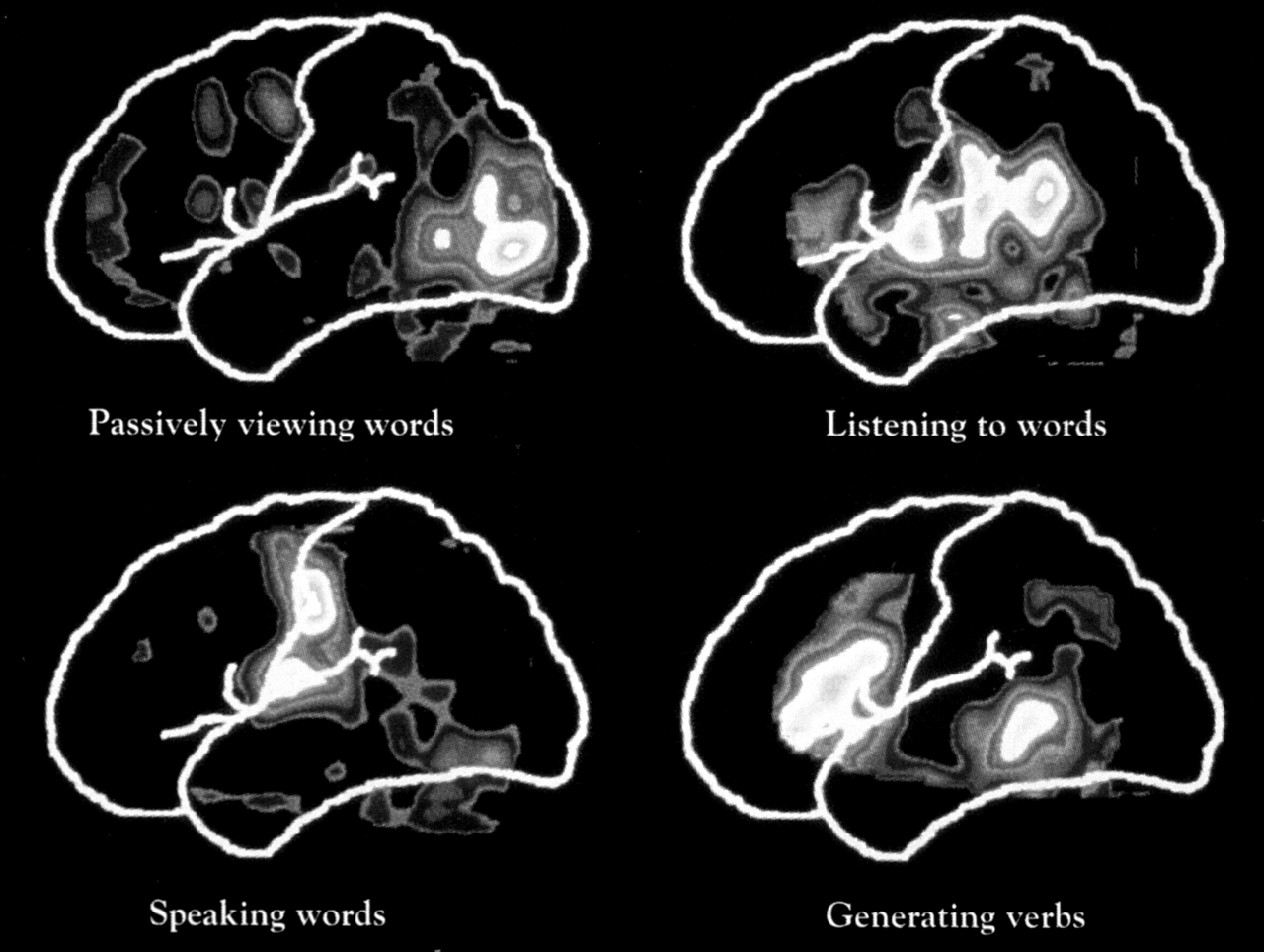 Brain scans showing activation patterns during different language tasks