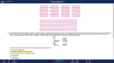 ECG image