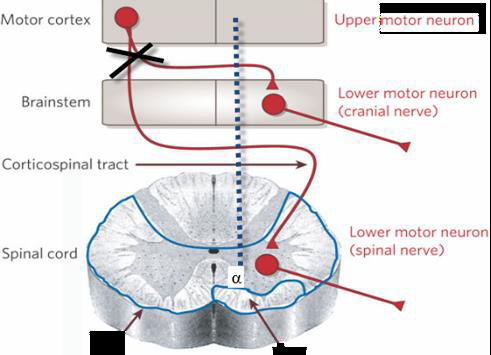 upper and lower motor neurons diagram