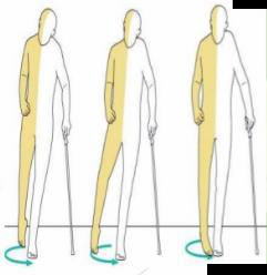 Three gait figures showing hemiplegic walking