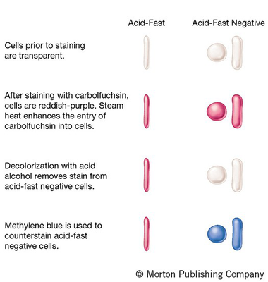 Diagram illustrating the steps of the Acid-Fast ZN staining method. It shows the appearance of cells before staining (transparent), after staining with carbolfuchsin (reddish-purple), after decolorization with acid alcohol (acid-fast cells retain color, others lose it), and after counterstaining with methylene blue (acid-fast cells are reddish-purple, non-acid-fast cells are blue).