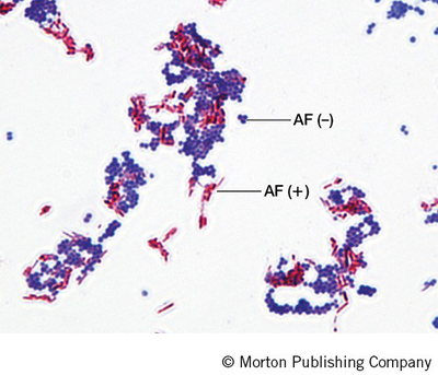 Microscopic image of ZN stained bacteria