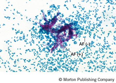 Microscopic image of K method stained bacteria