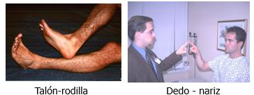 Two medical tests: Talón‑rodilla y Dedo‑nariz