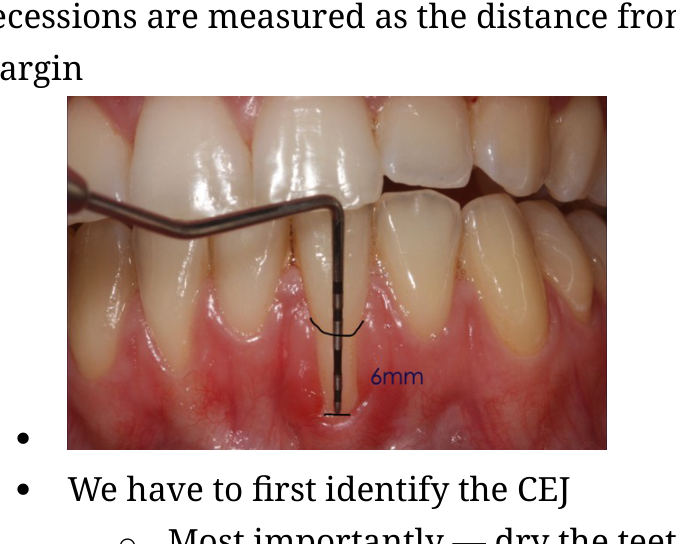 Periodontal probe measurement