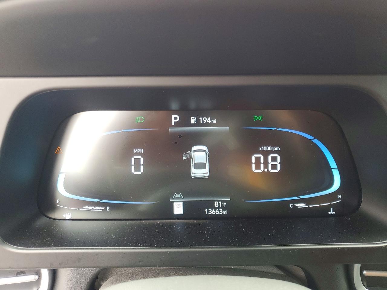 2025 HYUNDAI ELANTRA SEL SPORT photo 17