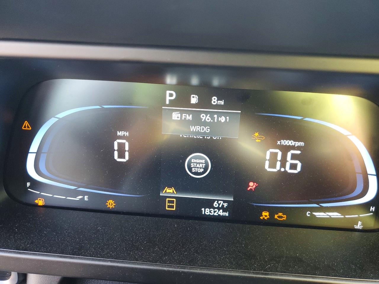 2025 HYUNDAI ELANTRA SEL SPORT photo 17