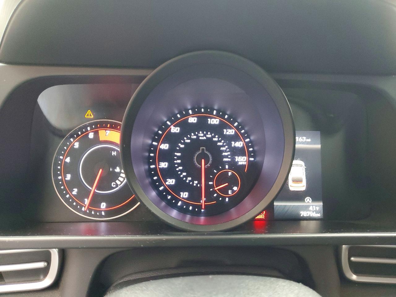 2021 HYUNDAI ELANTRA SE photo 17