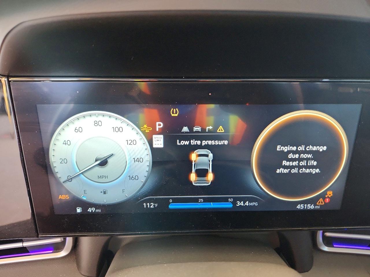 2024 HYUNDAI ELANTRA SEL photo 25