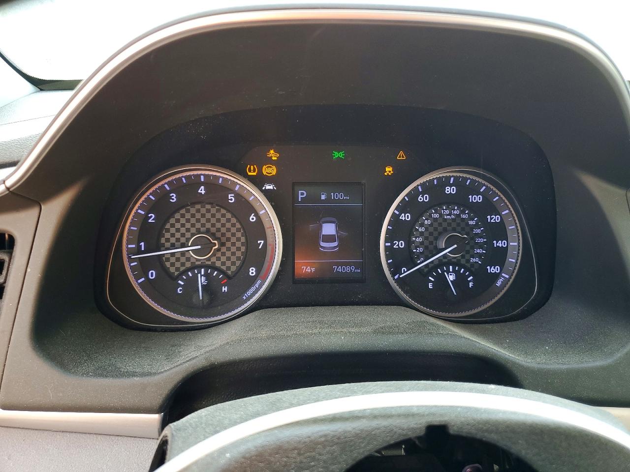 2020 HYUNDAI ELANTRA SEL photo 17