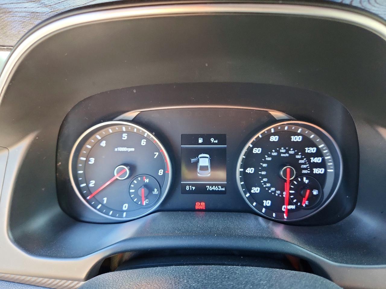 2019 HYUNDAI ELANTRA SPORT photo 17