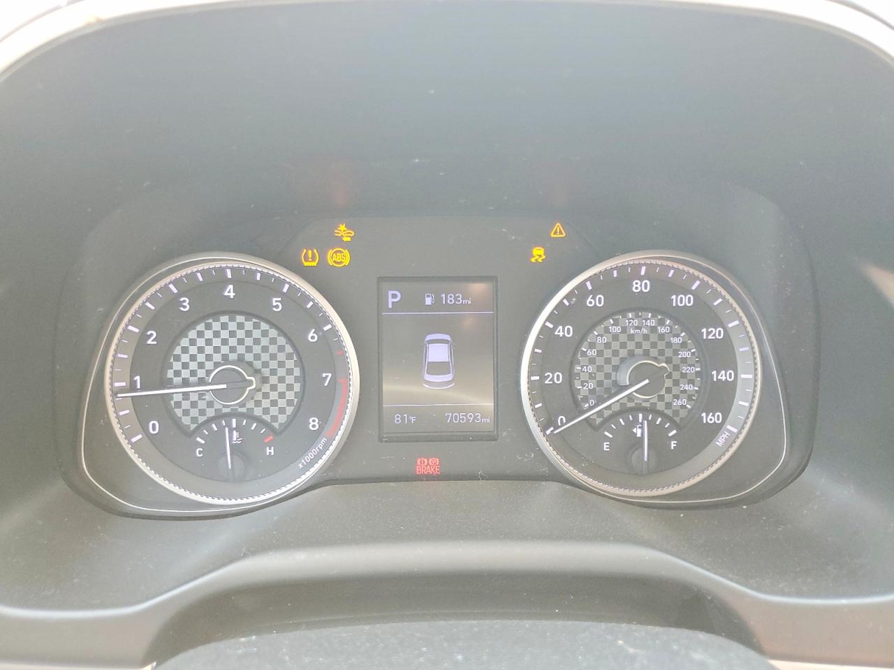 2020 HYUNDAI ELANTRA SEL photo 22