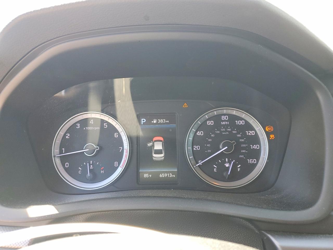 2018 HYUNDAI SONATA SEL photo 17