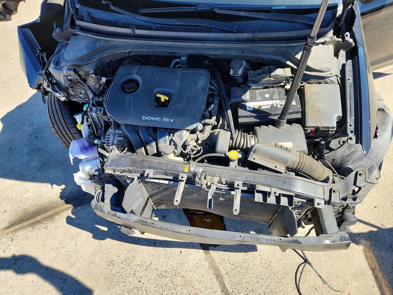2017 HYUNDAI ELANTRA SE photo 31