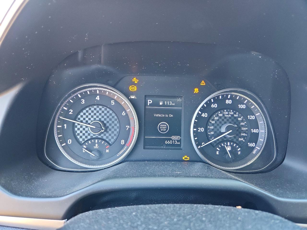 2020 HYUNDAI ELANTRA VALUE EDITION photo 9
