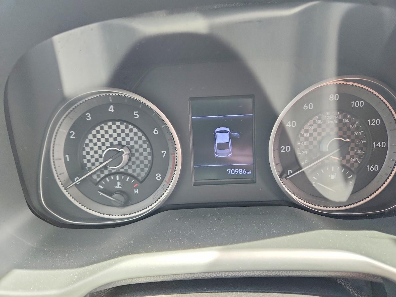 2020 HYUNDAI ELANTRA SE photo 25